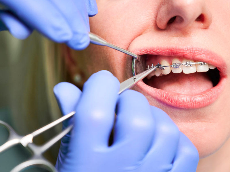 Valdoly orthodontie
