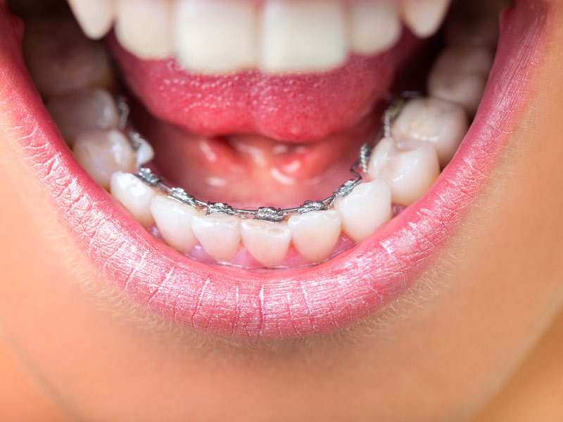 Valdoly orthodontie